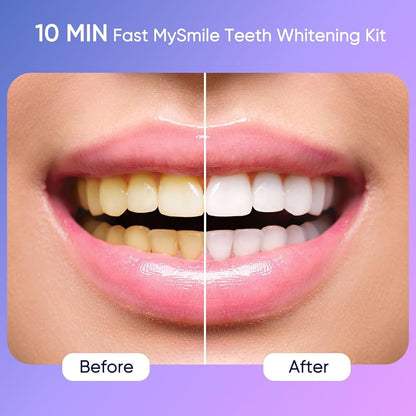 Lápiz Blanqueador Dental Instantáneo WhiteFlash